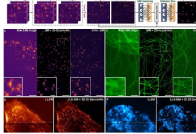 科学家提出零样本通用显微图像AI处理方法