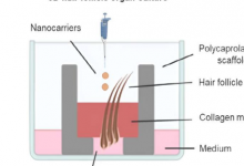 研究人员开发出3D打印模型用于对毛囊感染的靶向抗生素治疗