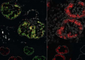 研究揭示基因如何指导小鼠和人类的肾脏以不同的方式发育