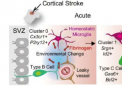 中风破坏干细胞的神经元形成：研究揭示潜在机制