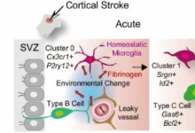 中风破坏干细胞的神经元形成：研究揭示潜在机制