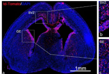 独特的 mRNA 传递方法可以在出生前修复有缺陷的基因